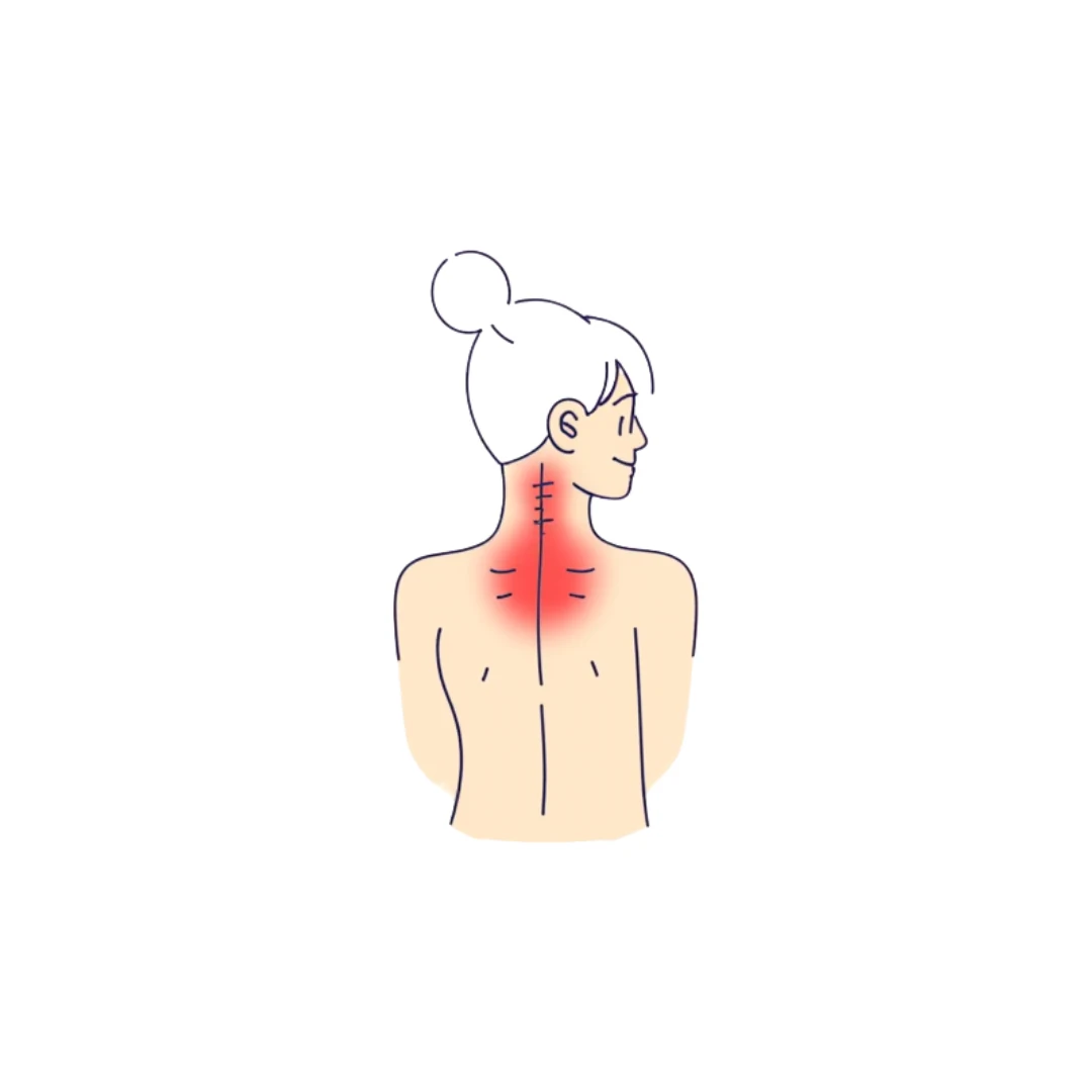 Illustration eines Rückens mit hervorgehobenem Nackenbereich als Symbol für Verspannungen
